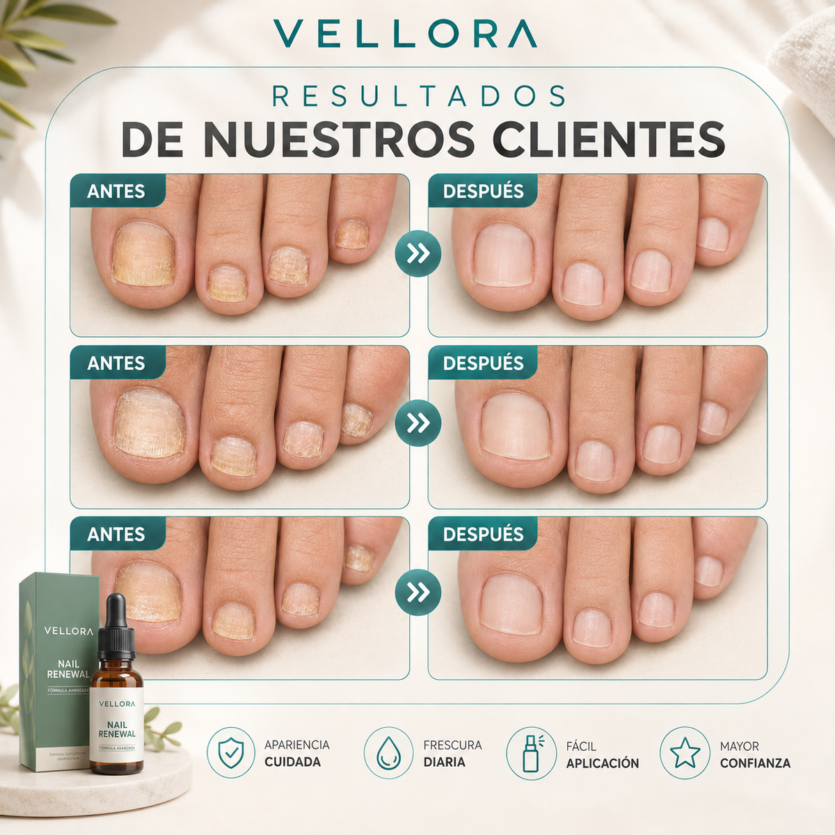 Vuelve a Sentir Confianza en Tus Pies +ENVIO GRATIS🚚🏠