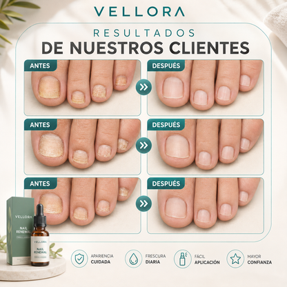 Vuelve a Sentir Confianza en Tus Pies +ENVIO GRATIS🚚🏠