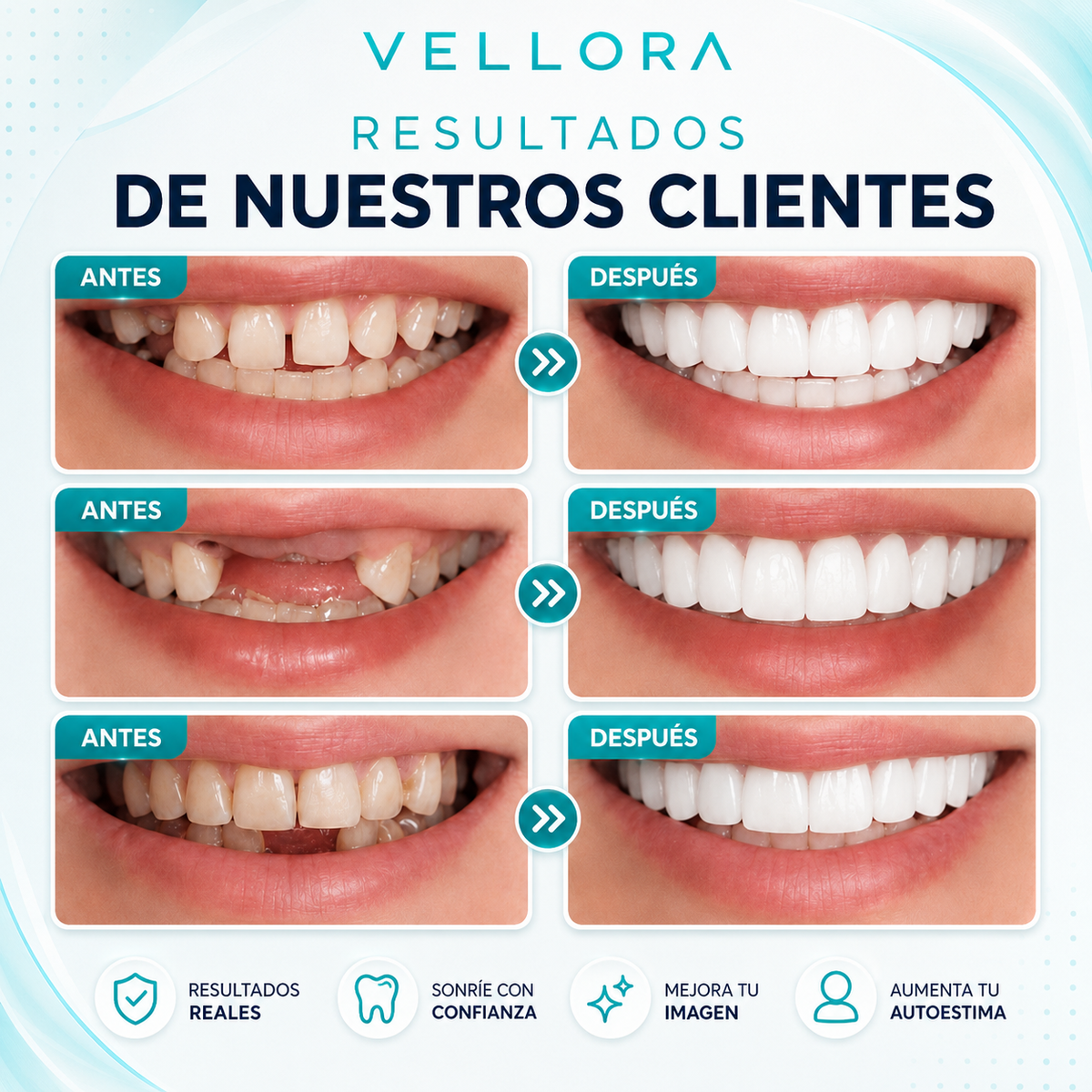 💚VUELVE A SONREIR CON CONFIANZA✨ 2X1 +Envío Gratis🏡🚚