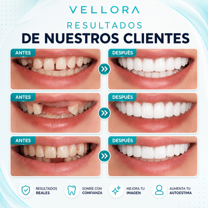 💚VUELVE A SONREIR CON CONFIANZA✨ 2X1 +Envío Gratis🏡🚚