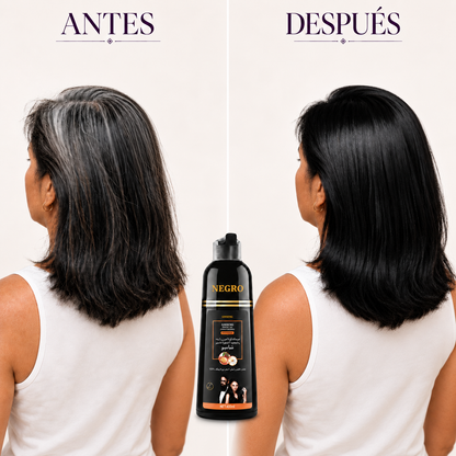 SHAMPOO ANTICANAS; REPARACION Y PROTECCION EN CADA APLICACION +ENVIO GRATIS 🚚🏠
